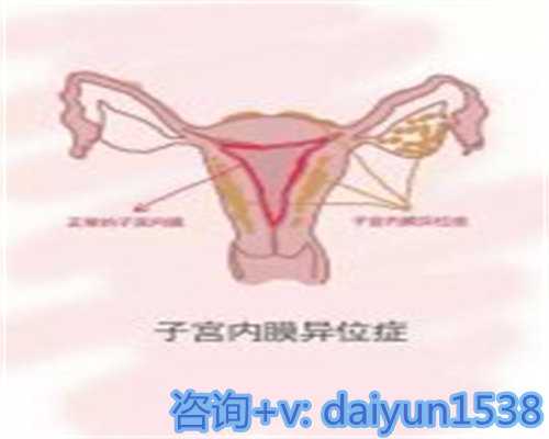 重庆人工授精与畸形精子处理及助孕选择指南