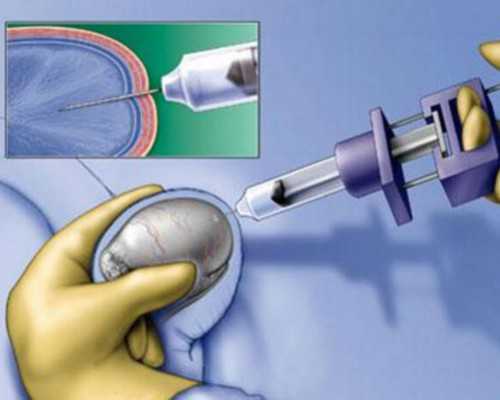 重庆代怀选男女,【重庆哪家生殖科好】重庆最大辅助生殖公司