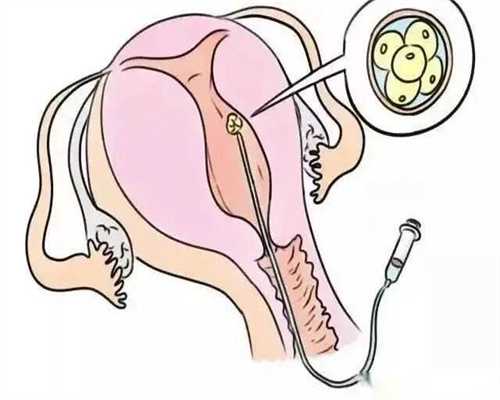 重庆代孕妈妈费用解析与试管医院排名指南