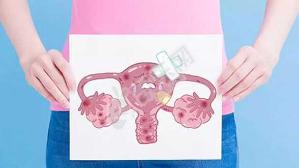 重庆合法代怀孕流程,女性患有始基子宫怎么办